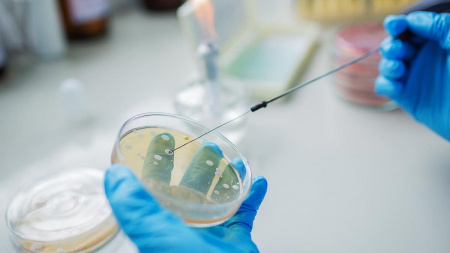 bacteriological analysis
